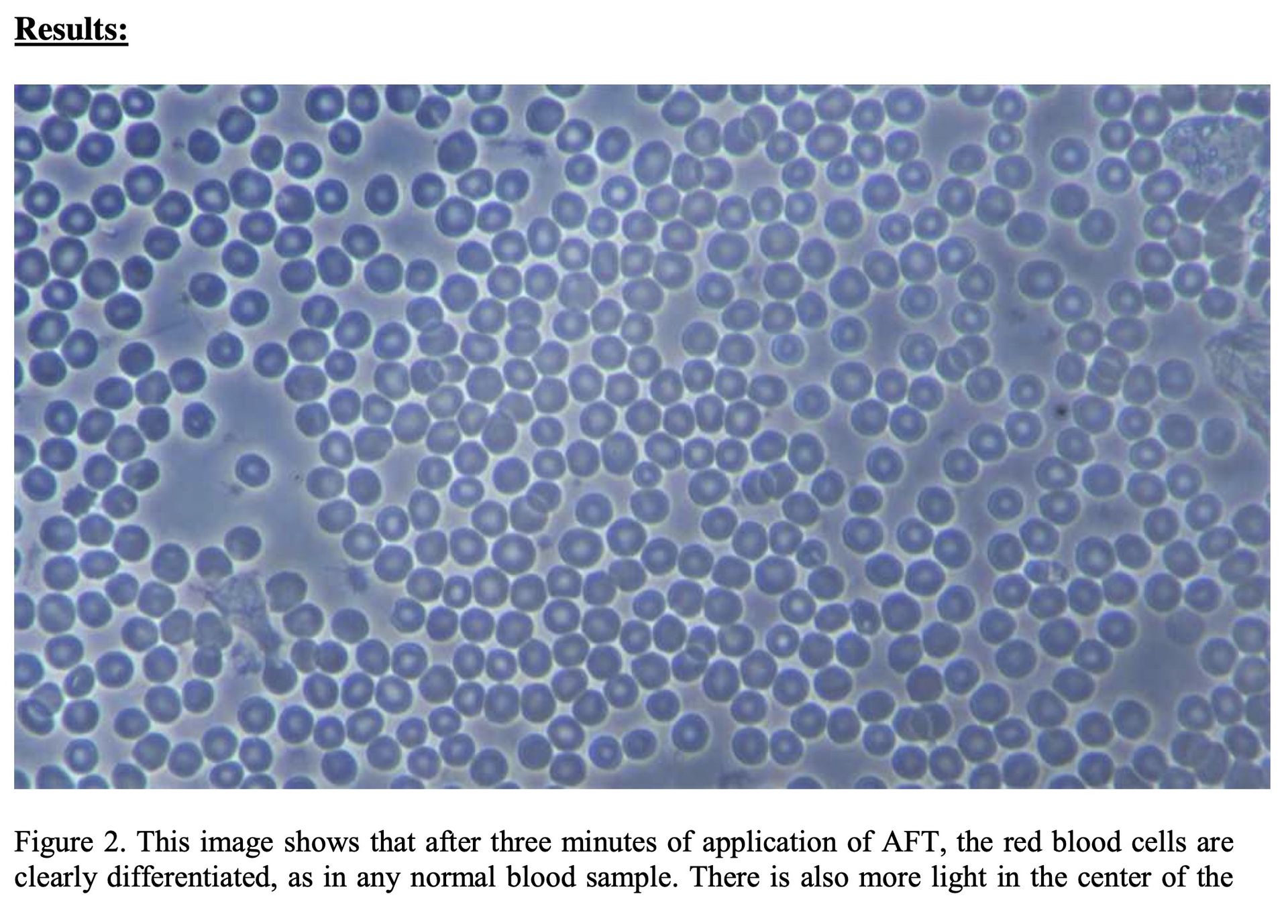 Blood Sample AFTER AFT Blood Sample AFTER AFT